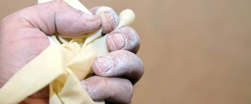 Uczulenie na materac objawy: Jak rozpoznać i uniknąć problemów zdrowotnych